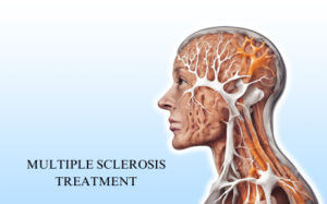 Experience Unparalleled Care with the Best Multiple Sclerosis Treatment in Hyderabad at Dr. Sriram Neuro. Let Us Guide You Towards a Brighter Future with Expert Care and Support.