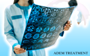 Looking for Acute Disseminated Encephalomyelitis (ADEM) Treatment in Hyderabad? Let us Guide Your Journey to Recovery with Expert Care and Compassion.