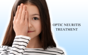 For a Holistic Journey to Optimal Recovery with Top-Notch Optic Neuritis Treatment in Hyderabad, Trust Dr. Sriram Neuro for Expert Care and Lasting Relief.